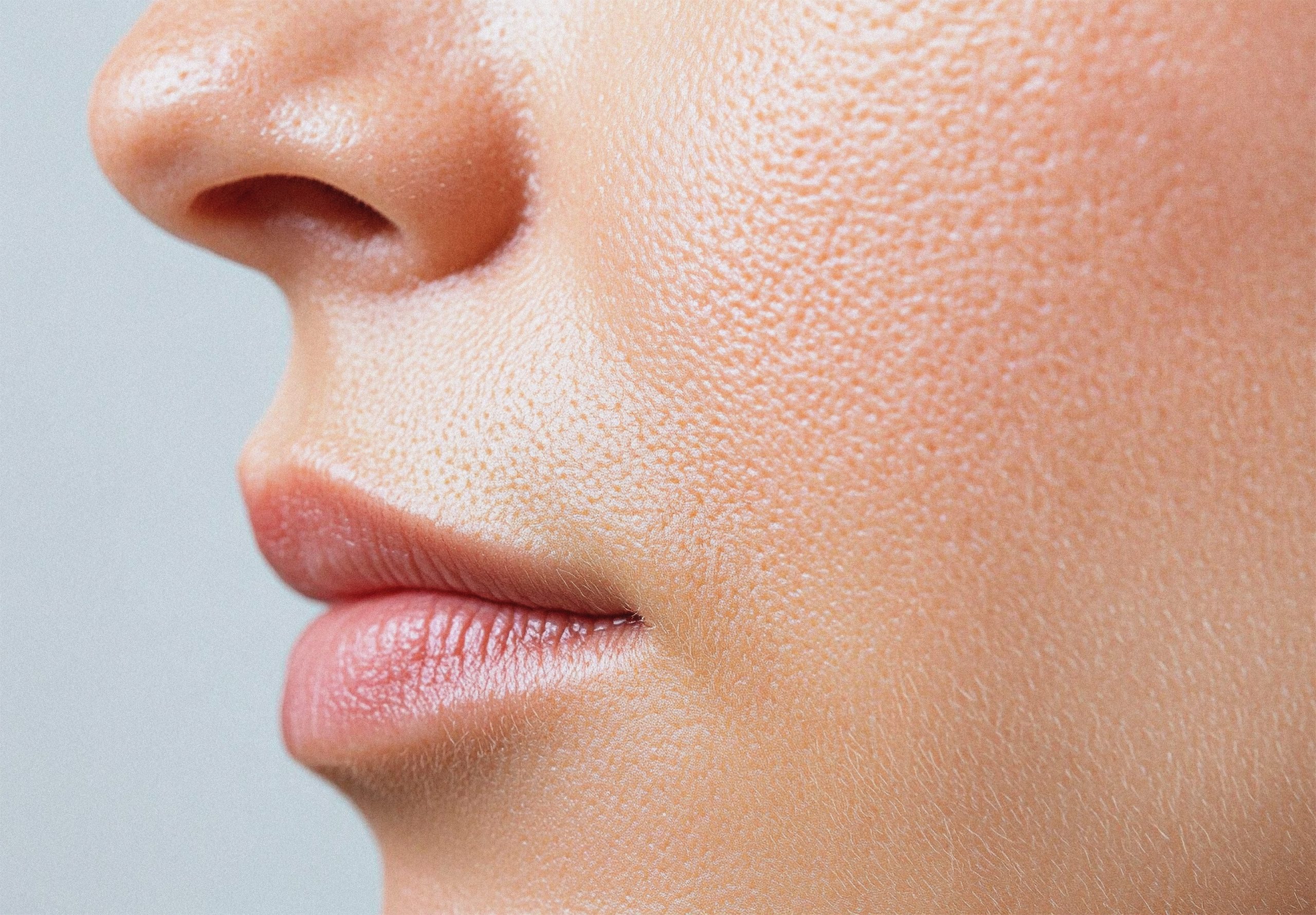 Poros abiertos en la cara